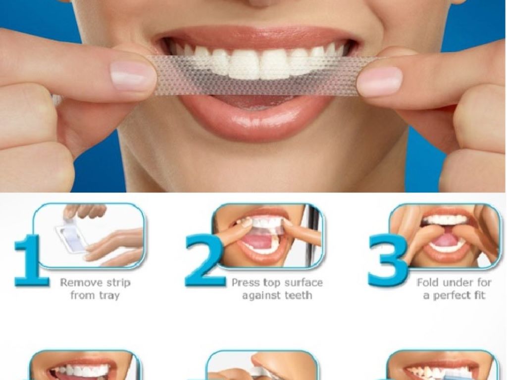 How to choose teeth whitening strips